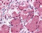 KIAA0152 / MLEC Antibody (Internal)